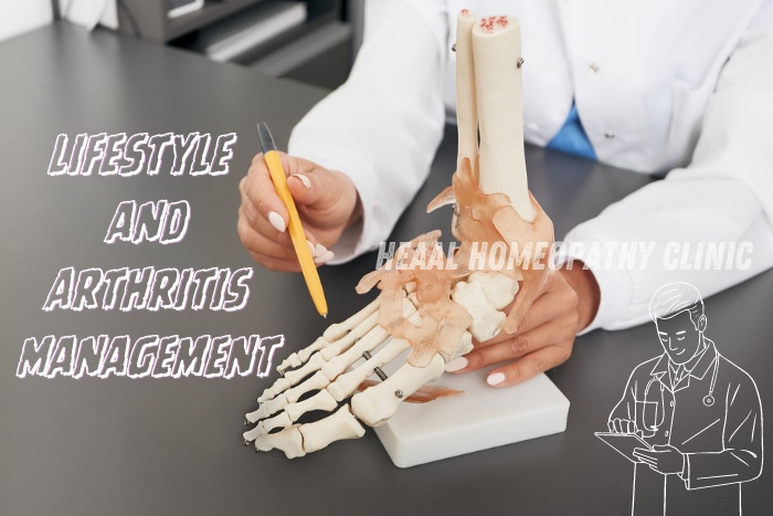 HEAAL Homeopathy Clinic in Chanda Nagar, Hyderabad offers specialized guidance on lifestyle and arthritis management, illustrated by a homeopathic doctor demonstrating on a skeletal hand model, emphasizing holistic treatment options