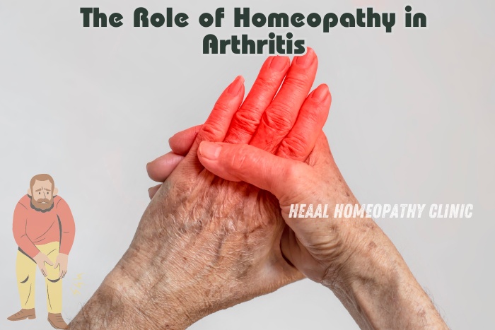 The role of homeopathy in arthritis treatment at HEAAL Homeopathy Clinic, Chanda Nagar, Hyderabad. Personalized homeopathic remedies to ease arthritis pain and improve joint health