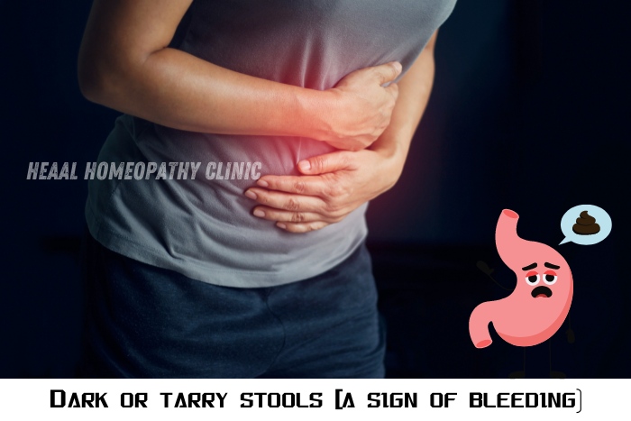 Dark or tarry stools indicating internal bleeding - a symptom of digestive issues treated at HEAAL Homeopathy Clinic, Chanda Nagar, Hyderabad