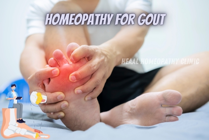 Homeopathy for gout treatment at HEAAL Homeopathy Clinic in Chanda Nagar, Hyderabad. A person holds their inflamed foot, highlighting the discomfort caused by gout. This image emphasizes the clinic's holistic approach to providing relief and treatment for gout through personalized homeopathic remedies