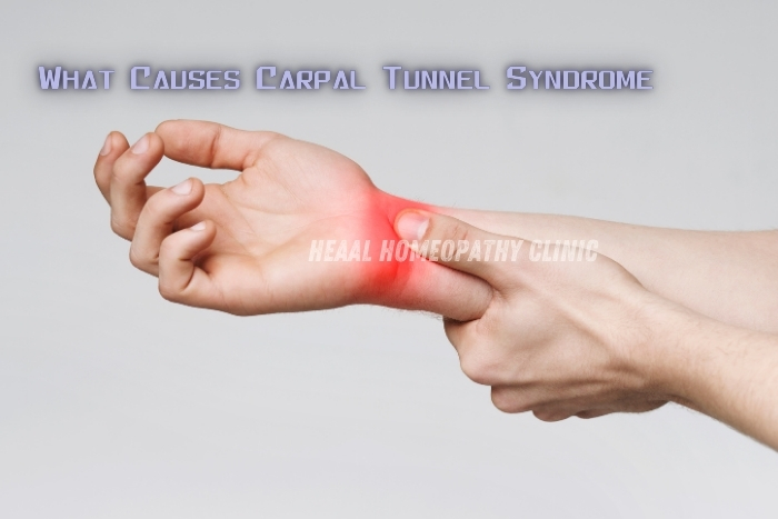 What causes Carpal Tunnel Syndrome? Learn more at HEAAL Homeopathy Clinic, Chanda Nagar, Hyderabad. Offering natural homeopathic solutions for pain relief and recovery