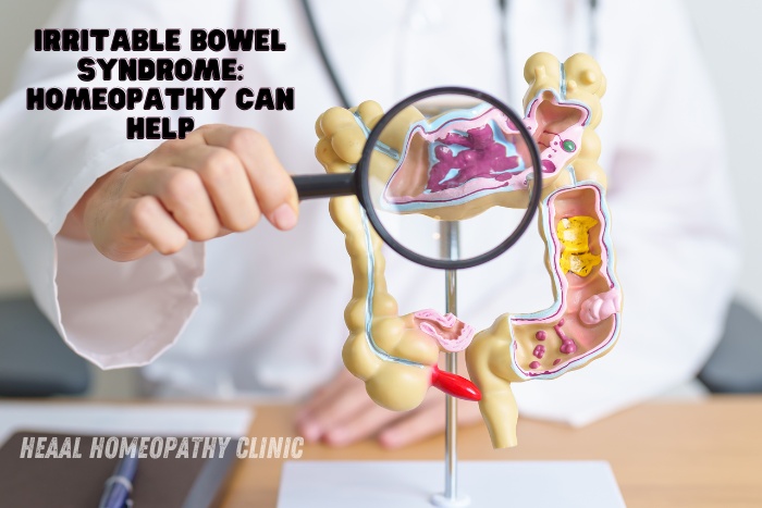 HEAAL Homeopathy Clinic in Chanda Nagar, Hyderabad offers personalized homeopathic remedies for IBS