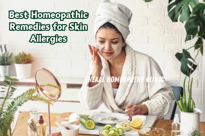 A woman applying a natural face mask in a spa-like setup, promoting healthy skin care at HEAAL Homeopathy Clinic in Chanda Nagar, Hyderabad